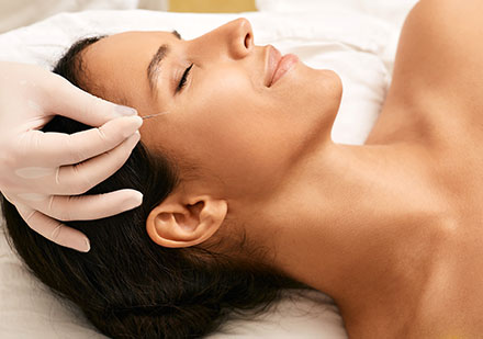 Acupuntura Facial